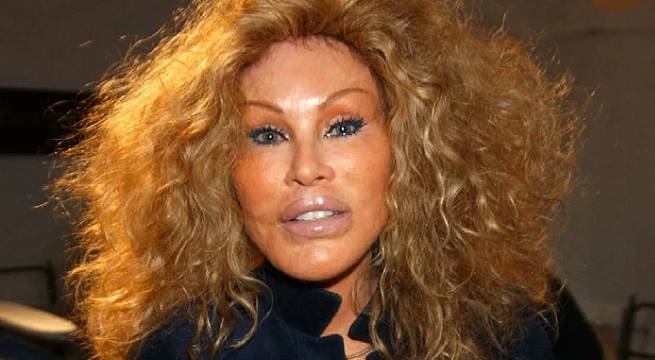 Murió Jocelyn Wildenstein, la 'Mujer gato', figura de la alta sociedad neoyorquina