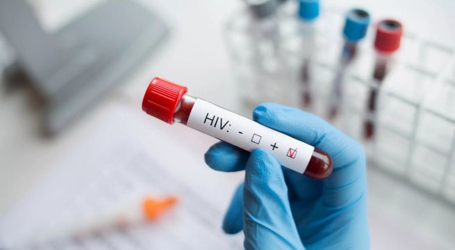 Perú registró más de 8 mil casos de VIH el último año, ¿existe verdaderamente una pandemia?