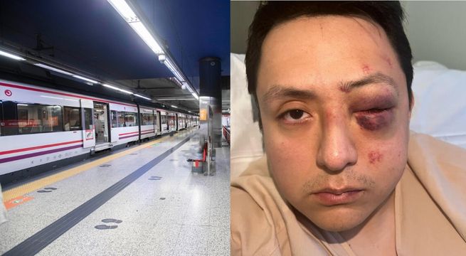 Peruano casi pierde un ojo tras brutal agresión racista en España: esto se sabe